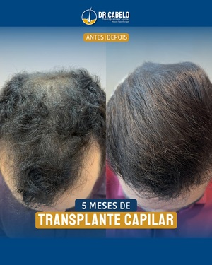 resultados clinica dr cabelo (1)