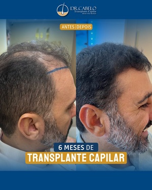 resultados clinica dr cabelo (2)