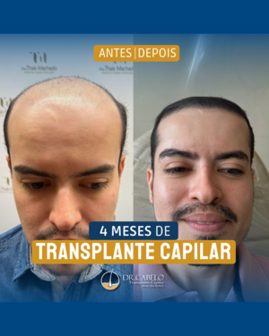 resultados clinica dr cabelo (4)