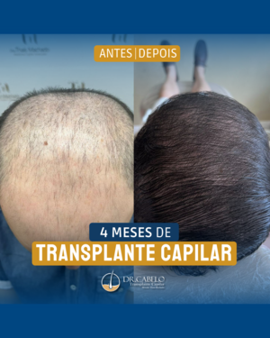 resultados clinica dr cabelo (5)