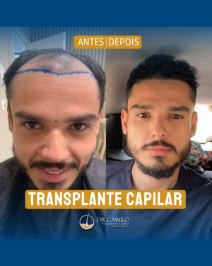 resultados clinica dr cabelo (7)